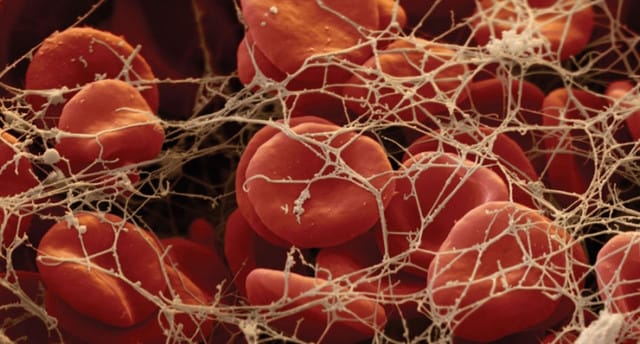 фібриноген