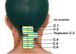 Зміщення хребців